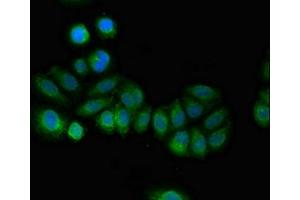 Immunofluorescent analysis of A549 cells using ABIN7146282 at dilution of 1:100 and Alexa Fluor 488-congugated AffiniPure Goat Anti-Rabbit IgG(H+L) (RCAN2 抗体  (AA 88-197))