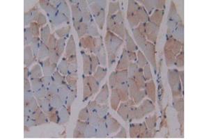 DAB staining on IHC-P Samples:Mouse Skeletal Muscle Tissue (beta-2 Microglobulin 抗体  (AA 22-119))