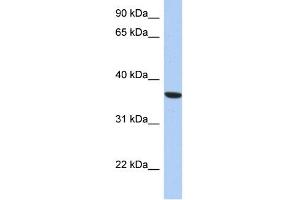 WB Suggested Anti-PSTK Antibody Titration: 0. (PSTK 抗体  (Middle Region))