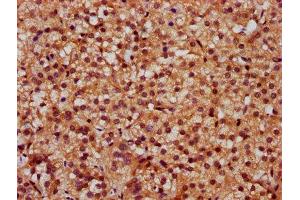 Immunohistochemistry (IHC) image for anti-Solute Carrier Family 26 (Sulfate Transporter), Member 2 (SLC26A2) (AA 614-739) antibody (ABIN7170935)