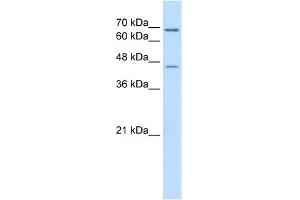 WB Suggested Anti-ALDH3A2 Antibody Titration:  0. (ALDH3A2 抗体  (C-Term))