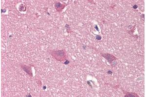Human Brain, Cortex (formalin-fixed, paraffin-embedded) stained with DCK antibody ABIN299601 at 20 ug/ml followed by biotinylated goat anti-rabbit IgG secondary antibody ABIN481713, alkaline phosphatase-streptavidin and chromogen. (DCK 抗体  (N-Term))