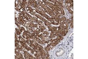 Immunohistochemical staining of human liver with ZCCHC24 polyclonal antibody  shows strong cytoplasmic positivity in hepatocytes while bile duct cells were negative at 1:200-1:500 dilution. (ZCCHC24 抗体)