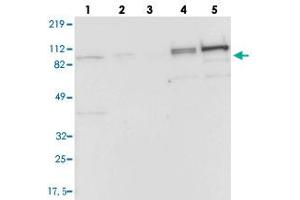 Western blot analysis of Lane 1: RT-4, Lane 2: EFO-21, Lane 3: A-431, Lane 4: Liver, Lane 5: Tonsil with CFB polyclonal antibody . (Complement Factor B 抗体)