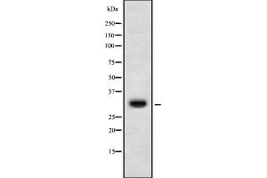 Western blot analysis of HoxD10 using K562 whole cell lysates (HOXD10 抗体  (Internal Region))
