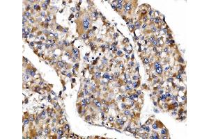 IHC analysis of MRPS25 using anti-MRPS25 antibody (ABIN7599032).