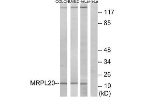 Western blot analysis of extracts from COLO cells, HUVEC cells and HeLa cells, using MRPL20 antibody. (MRPL20 抗体  (C-Term))