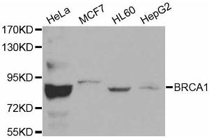 Western blot analysis of extracts of various cell lines, using BRCA1 antibody (ABIN5970045). (BRCA1 抗体)