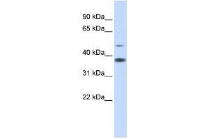 Western Blotting (WB) image for anti-Methylmalonic Aciduria (Cobalamin Deficiency) CblD Type, with Homocystinuria (MMADHC) antibody (ABIN2459880) (MMADHC 抗体)