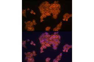 Immunofluorescence analysis of HeLa cells using PMP70/ Rabbit mAb (ABIN1683181, ABIN3018647, ABIN3018648 and ABIN7101638) at dilution of 1:100 (40x lens). (CX3CL1 抗体)