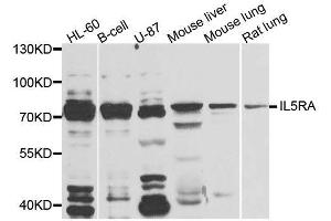 Western blot analysis of extracts of various cell lines, using IL5RA antibody (ABIN5996447) at 1/1000 dilution. (IL5RA 抗体)