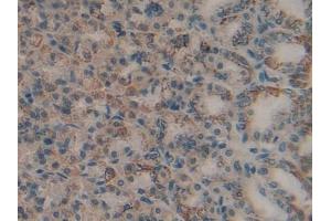 Immunohistochemistry (IHC) image for anti-Matrix Metallopeptidase 9 (Gelatinase B, 92kDa Gelatinase, 92kDa Type IV Collagenase) (MMP9) (AA 226-391) antibody (ABIN7432019)
