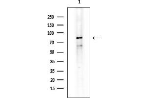 Western blot analysis of lysates from EC304 cells(heat-shock treatment), using ZNF280C Antibody at 1/1000 dilution.