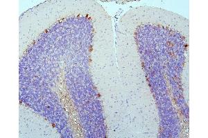 IHC analysis of DCC using anti-DCC antibody (ABIN7602566).
