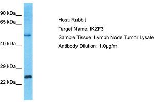 Host: Rabbit Target Name: IKZF3 Sample Type: Lymph Node Tumor lysates Antibody Dilution: 1.