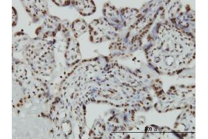 Immunoperoxidase of monoclonal antibody to HMGB2 on formalin-fixed paraffin-embedded human placenta. (HMGB2 抗体  (AA 1-195))