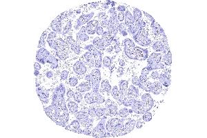 Mature placenta with a moderate to strong nuclear NFIX staining of stromal cells while trophoblast cells remain negative (Recombinant NFIX 抗体  (Center))