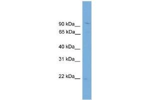 Human THP-1; WB Suggested Anti-TPPP3 Antibody Titration: 0. (TPPP3 抗体  (N-Term))