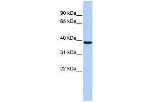 WB Suggested Anti-ALAD Antibody Titration:  0.