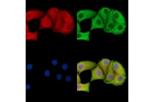 ABIN7095701 and ABIN7099763 staining Hela cells by IF/ICC. (SLC13A3 抗体)
