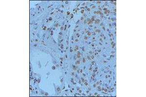 Formalin-PBS and Bouin embedded paraffin human renal tissue pretreated with heat induced epitope retrieval Citrate buffer pH 6. (GREM1 抗体  (C-Term))