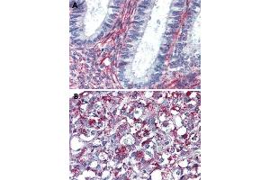 Immunohistochemical staining of formalin-fixed, paraffin-embedded human uterus (A) and human adrenal gland (B) tissue after heat-induced antigen retrieval. (Angiotensin II Type 2 Receptor 抗体  (Internal Region))