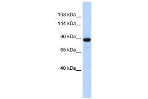 PDE3A antibody used at 1 ug/ml to detect target protein. (PDE3A 抗体  (N-Term))