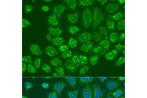 Immunofluorescence analysis of U2OS cells using MTDH Polyclonal Antibody at dilution of 1:100. (MTDH 抗体)