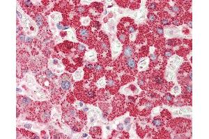 Anti-RBM38 antibody IHC staining of human liver. (RBM38 抗体  (AA 41-90))
