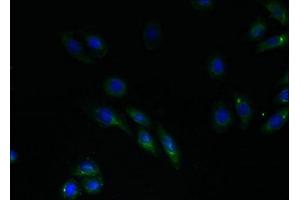 Immunofluorescent analysis of HepG2 cells using ABIN7151168 at dilution of 1:100 and Alexa Fluor 488-congugated AffiniPure Goat Anti-Rabbit IgG(H+L) (RNF183 抗体  (AA 1-161))