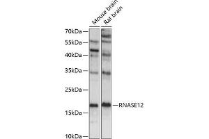 Western blot analysis of extracts of various cell lines, using RN antibody (ABIN7269985) at 1:1000 dilution. (RNASE12 抗体  (AA 1-100))
