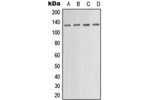 Western blot analysis of PKN1 expression in HEK293T (A), HepG2 (B), SP2/0 (C), NIH3T3 (D) whole cell lysates. (PKN1 抗体  (Center))