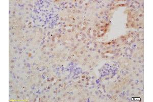 Immunohistochemistry (Paraffin-embedded Sections) (IHC (p)) image for anti-Nuclear Factor of kappa Light Polypeptide Gene Enhancer in B-Cells 2 (NFKB2) (AA 151-250) antibody (ABIN1386117)