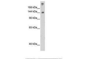 Image no. 3 for anti-Pre-mRNA Branch Site Protein p14 (SF3B14) (N-Term) antibody (ABIN203323) (Pre-mRNA Branch Site Protein p14 (SF3B14) (N-Term) 抗体)