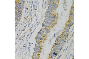 Immunohistochemistry of paraffin-embedded human colon carcinoma using GNAO1 Antibody (ABIN1872843) at dilution of 1:100 (40x lens). (GNAO1 抗体)