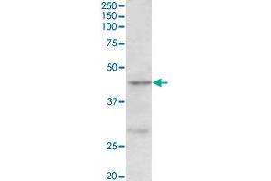 PRMT6 polyclonal antibody  (0. (PRMT6 抗体  (Internal Region))