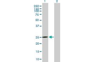 Western Blot analysis of MRPS10 expression in transfected 293T cell line by MRPS10 MaxPab polyclonal antibody. (MRPS10 抗体  (AA 1-201))