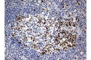 Image no. 6 for anti-Antigen Identified By Monoclonal Antibody Ki-67 (MKI67) (AA 1160-1493) antibody (ABIN1490857) (Ki-67 抗体  (AA 1160-1493))