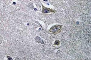 Immunohistochemistry (IHC) analyzes of NDUFV2 antibody in paraffin-embedded human brain tissue. (NDUFV2 抗体)