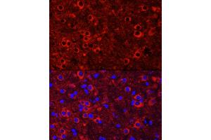 Immunofluorescence (IF) image for anti-Neurotrophic tyrosine Kinase, Receptor, Type 3 (NTRK3) (AA 40-300) antibody (ABIN6144910)