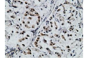 Image no. 1 for anti-EPM2A (Laforin) Interacting Protein 1 (EPM2AIP1) antibody (ABIN1498047) (EPM2AIP1 抗体)