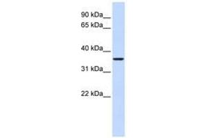 Image no. 1 for anti-Fructose-1,6-Bisphosphatase 2 (FBP2) (AA 216-265) antibody (ABIN6741005)