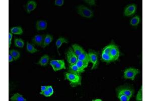 Immunofluorescent analysis of MCF-7 cells using ABIN7144733 at dilution of 1:100 and Alexa Fluor 488-congugated AffiniPure Goat Anti-Rabbit IgG(H+L) (GOT2 抗体  (AA 33-279))