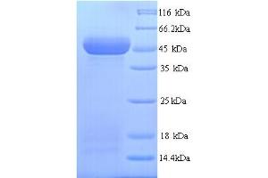 SDS-PAGE (SDS) image for Wingless-Type MMTV Integration Site Family, Member 10A (WNT10A) (AA 36-417) protein (His tag) (ABIN5714498)