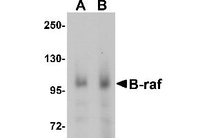 Western blot analysis of B-raf in human brain tissue lysate with B-raf antibody at (A) 1 and (B) 2 µg/mL. (SNRPE 抗体  (Middle Region))