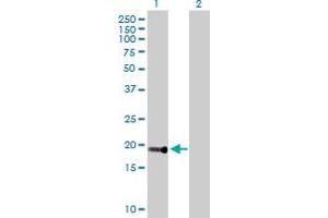 Western Blot analysis of DDIT4L expression in transfected 293T cell line by DDIT4L MaxPab polyclonal antibody. (DDIT4L 抗体  (AA 1-193))