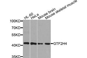 Western blot analysis of extracts of various cell lines, using GTF2H4 antibody. (GTF2H4 抗体)