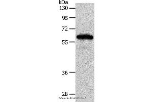 Western blot analysis of Mouse brain tissue, using INA Polyclonal Antibody at dilution of 1:550 (INA 抗体)
