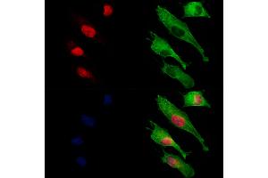 ABIN6261355 and ABIN6273229 staining HUVEC cells by IF/ICC. (DOM3Z 抗体  (Internal Region))