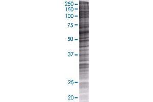 CES1 transfected lysate. (CES1 293T Cell Transient Overexpression Lysate(Denatured))